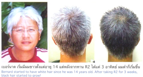 ผลลัพธ์เส้นผมจากอาร์สแควร์